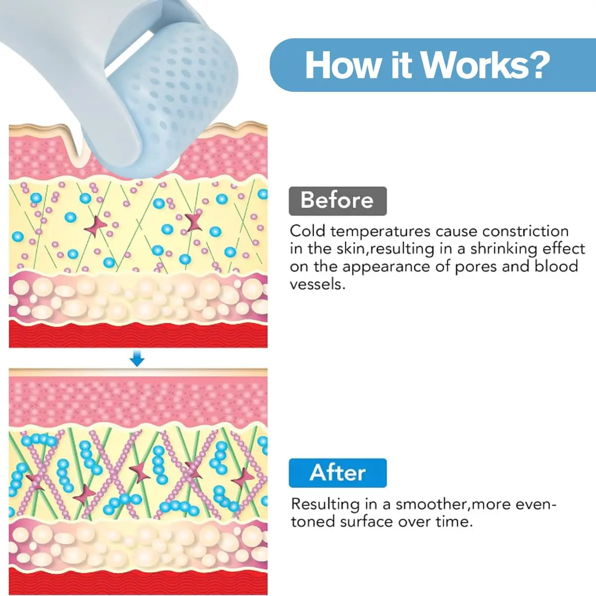 Ice Roller for Face & Eyes – Cooling Facial Massager to Reduce Puffiness & Refresh Skin IcePure Skincare